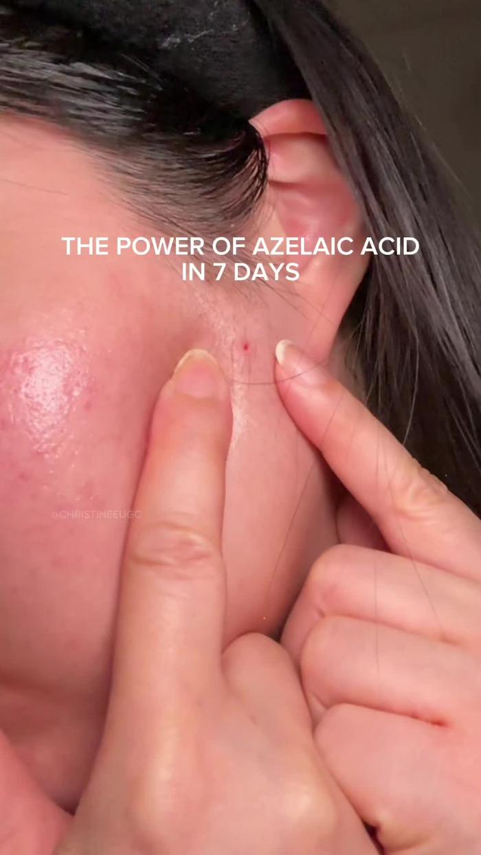 Post by christineeugc